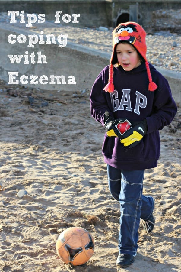 Coping with Eczema